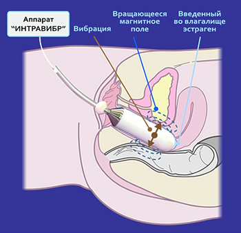 Излучатель бегущего магнитного поля